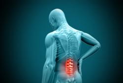 4a_workers-spinal-cord-injury