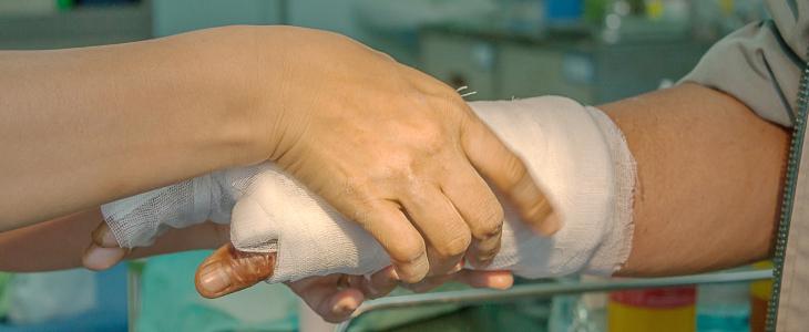 Person with hand wrapped after burn injury