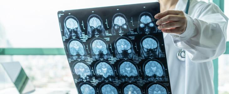Doctor holding brain scans.